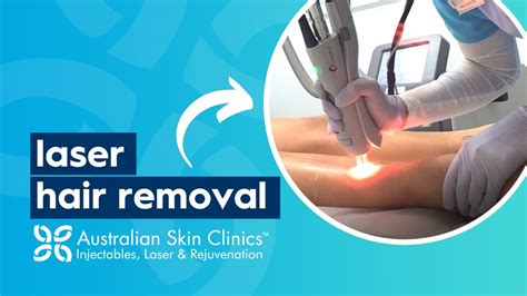 laser hair removal australia fair.